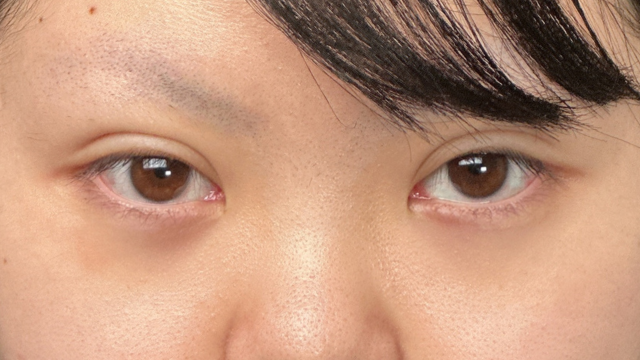 手术前的状态 其一