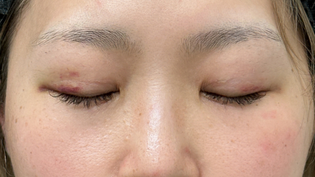 手术前的状态 其一