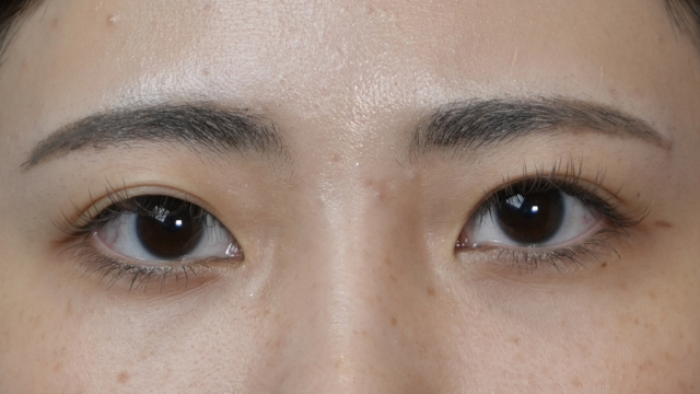 Postoperative Condition Part 1