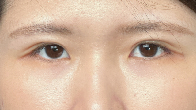 Postoperative Condition Part 1