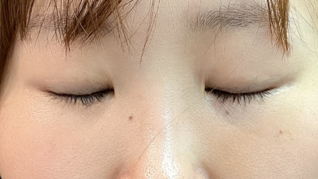 手术前的状态 其一