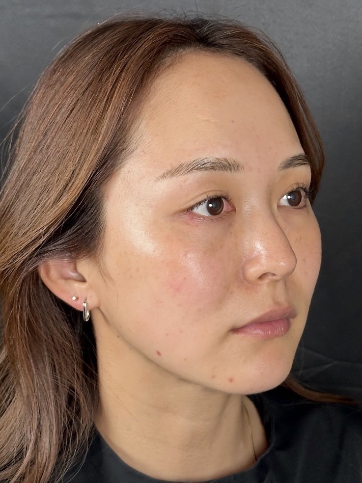 手术前的状态 其一