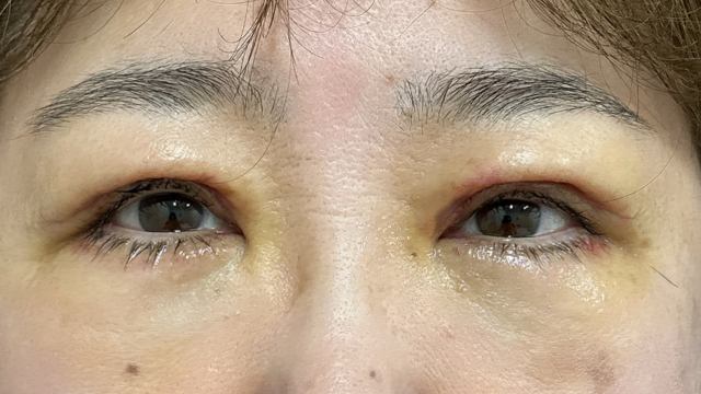 Postoperative Condition Part 1