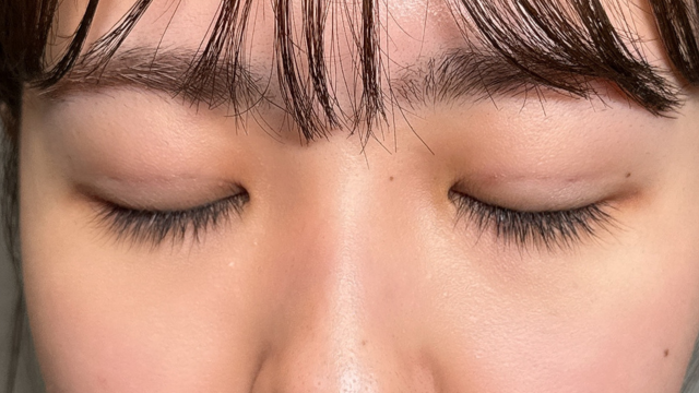 手术前的状态 其一