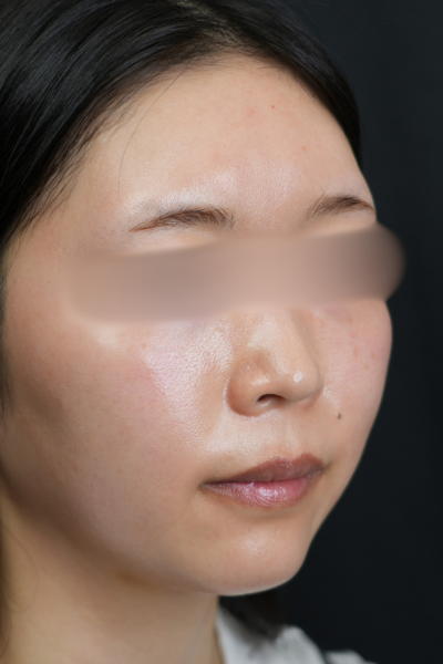 Postoperative Condition Part 1