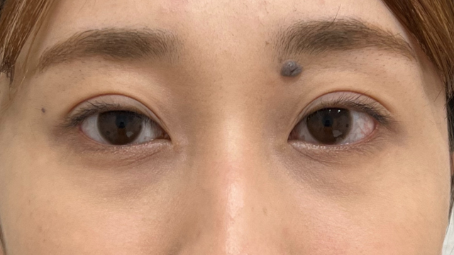 手术前的状态 其一