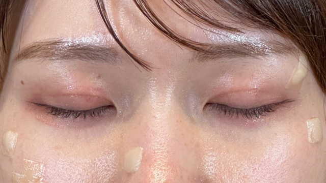 手术前的状态 其一