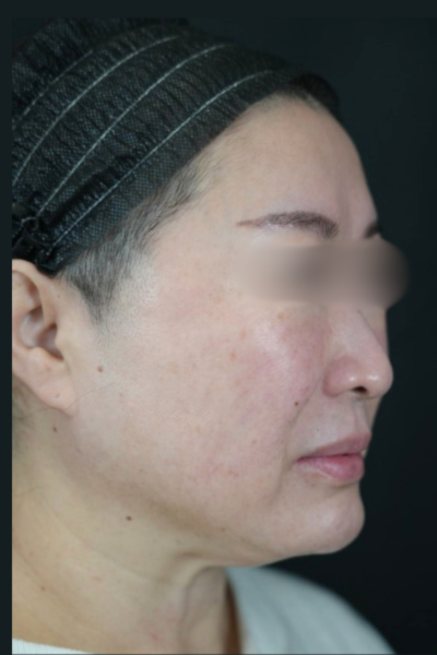 Postoperative Condition Part 1