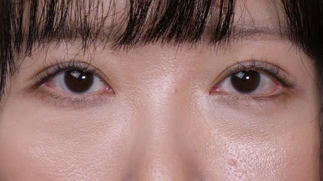 手术前的状态 其一