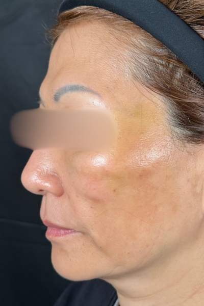 手术前的状态 其一