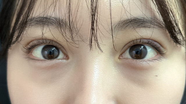 手术前的状态 其一