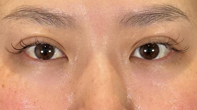 手术前的状态 其一