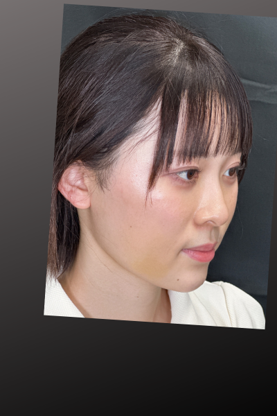 手術前の状態 その1