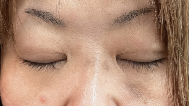 手术前的状态 其一