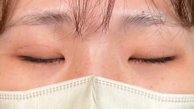 手术前的状态 其一