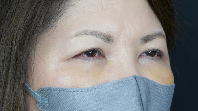 手術前の状態 その1