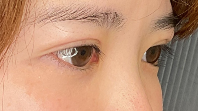 手术前的状态 其一