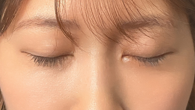 Postoperative Condition Part 1