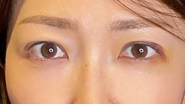 手术前的状态 其一