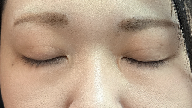 手術前の状態 その1