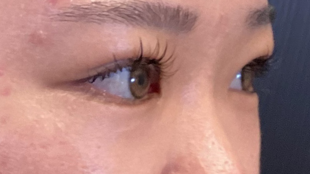 手術前の状態 その1