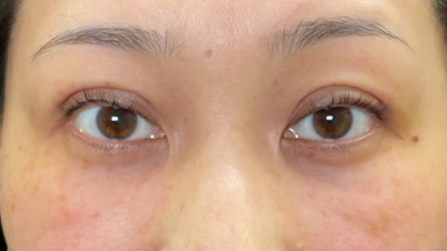 手术前的状态 其一