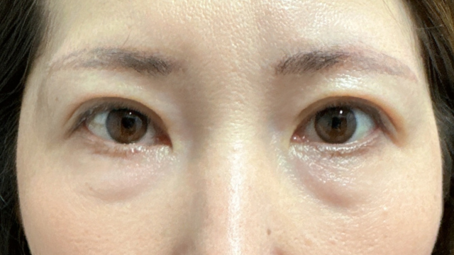 Postoperative Condition Part 1