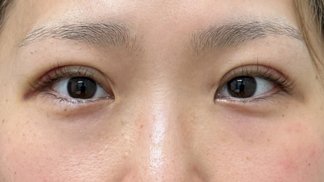 手术前的状态 其一