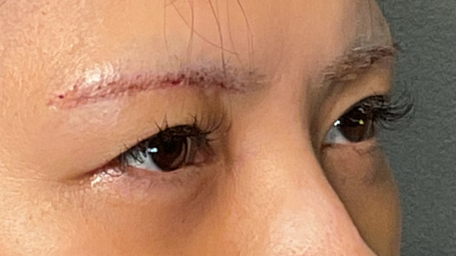 Postoperative Condition Part 1