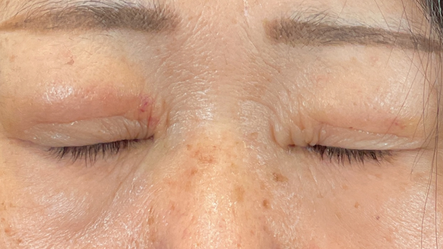 手术前的状态 其一