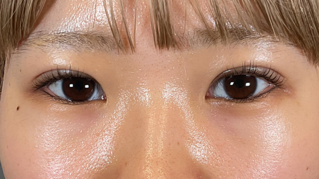 Postoperative Condition Part 1