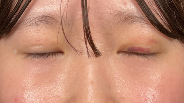 Postoperative Condition Part 1