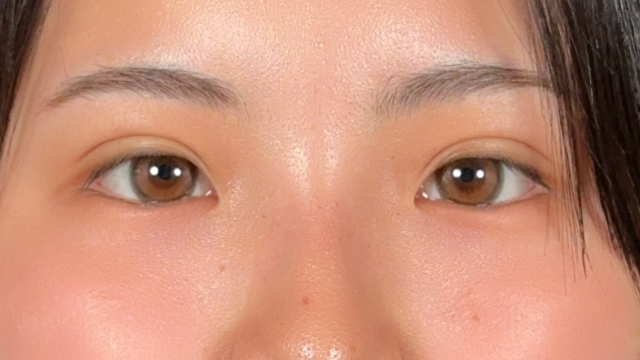 手术前的状态 其一