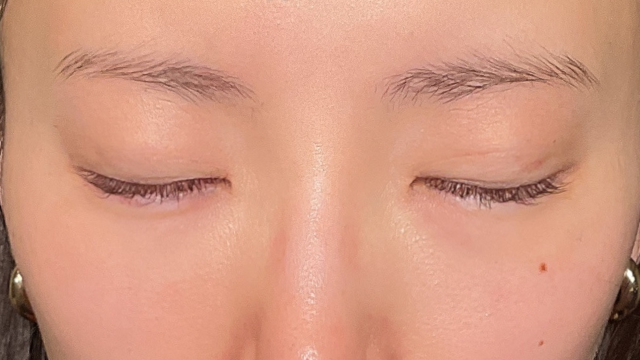 手术前的状态 其一