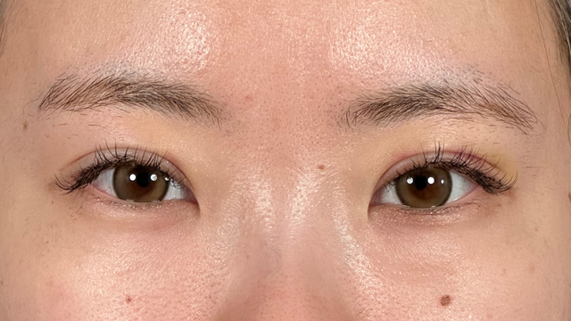 Postoperative Condition Part 1