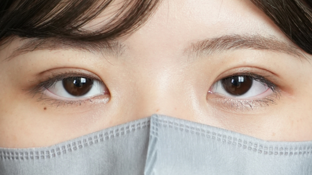 手术前的状态 其一