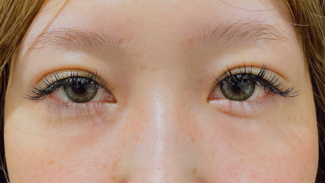 手术前的状态 其一