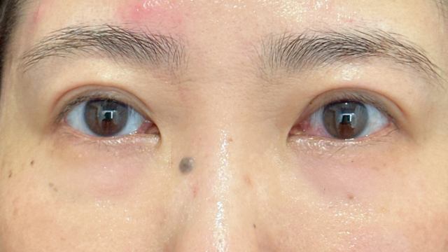 Postoperative Condition Part 1