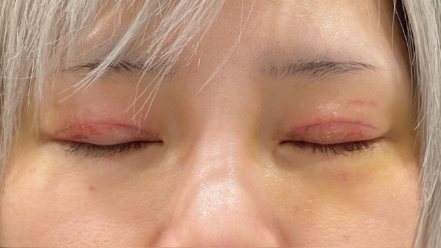 手術前の状態 その1