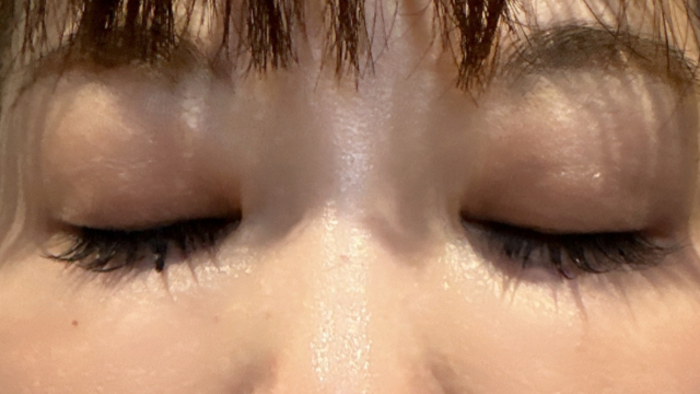 手术前的状态 其一