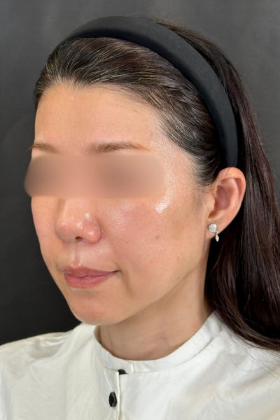 Postoperative Condition Part 1