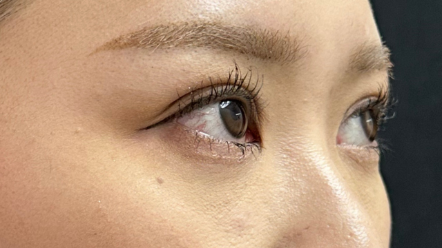 手术前的状态 其一