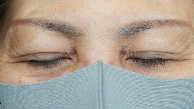 手术前的状态 其一