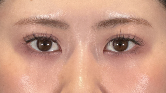 手术前的状态 其一