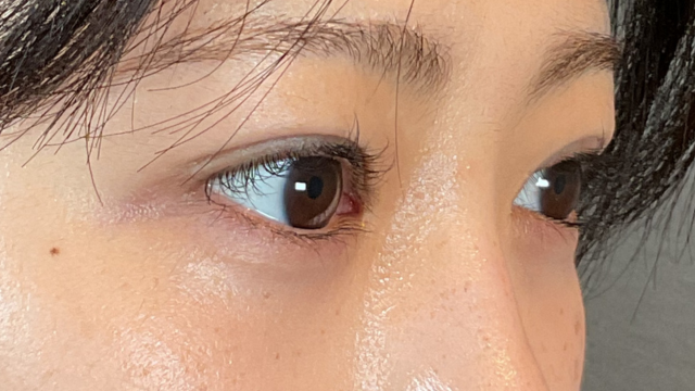 手术前的状态 其一