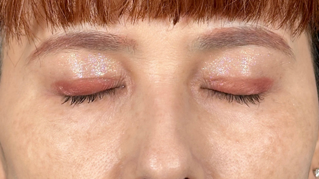 手术前的状态 其一