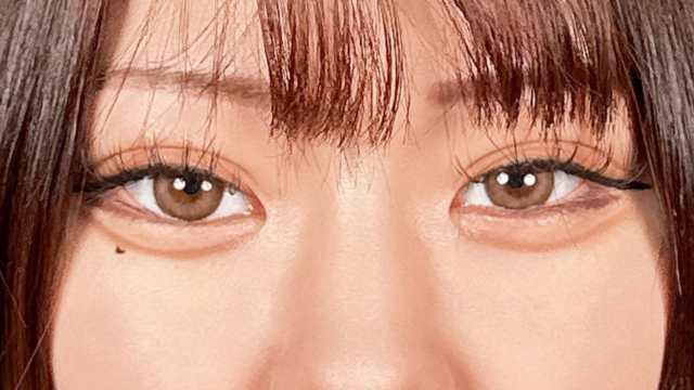 手术前的状态 其一