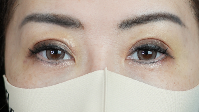 Postoperative Condition Part 1