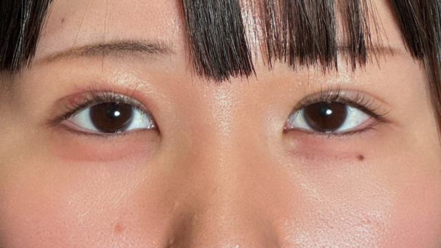 Postoperative Condition Part 1