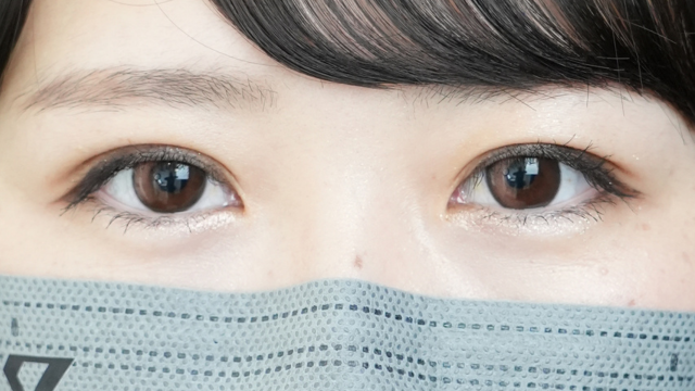 手术前的状态 其一